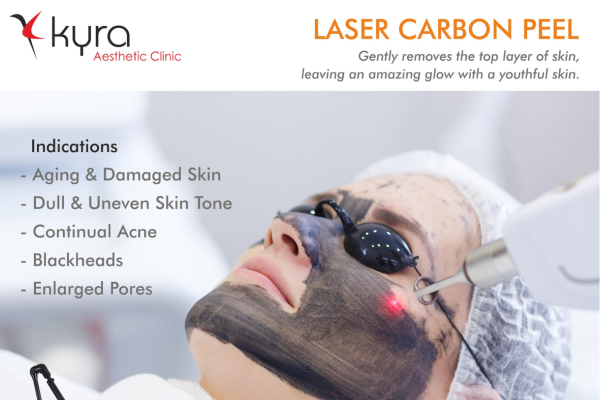 Laser Carbon Peel